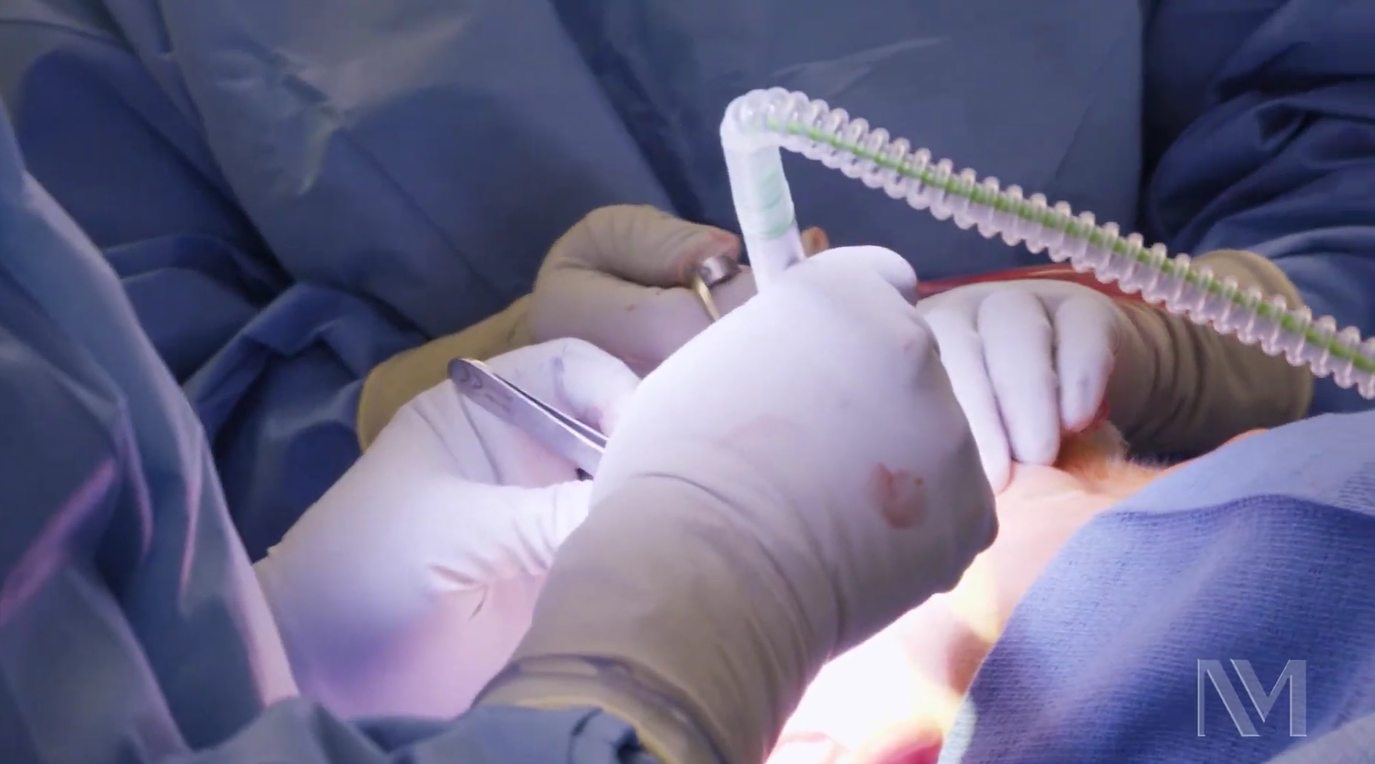 cilt-grefti-uygulamasi-1