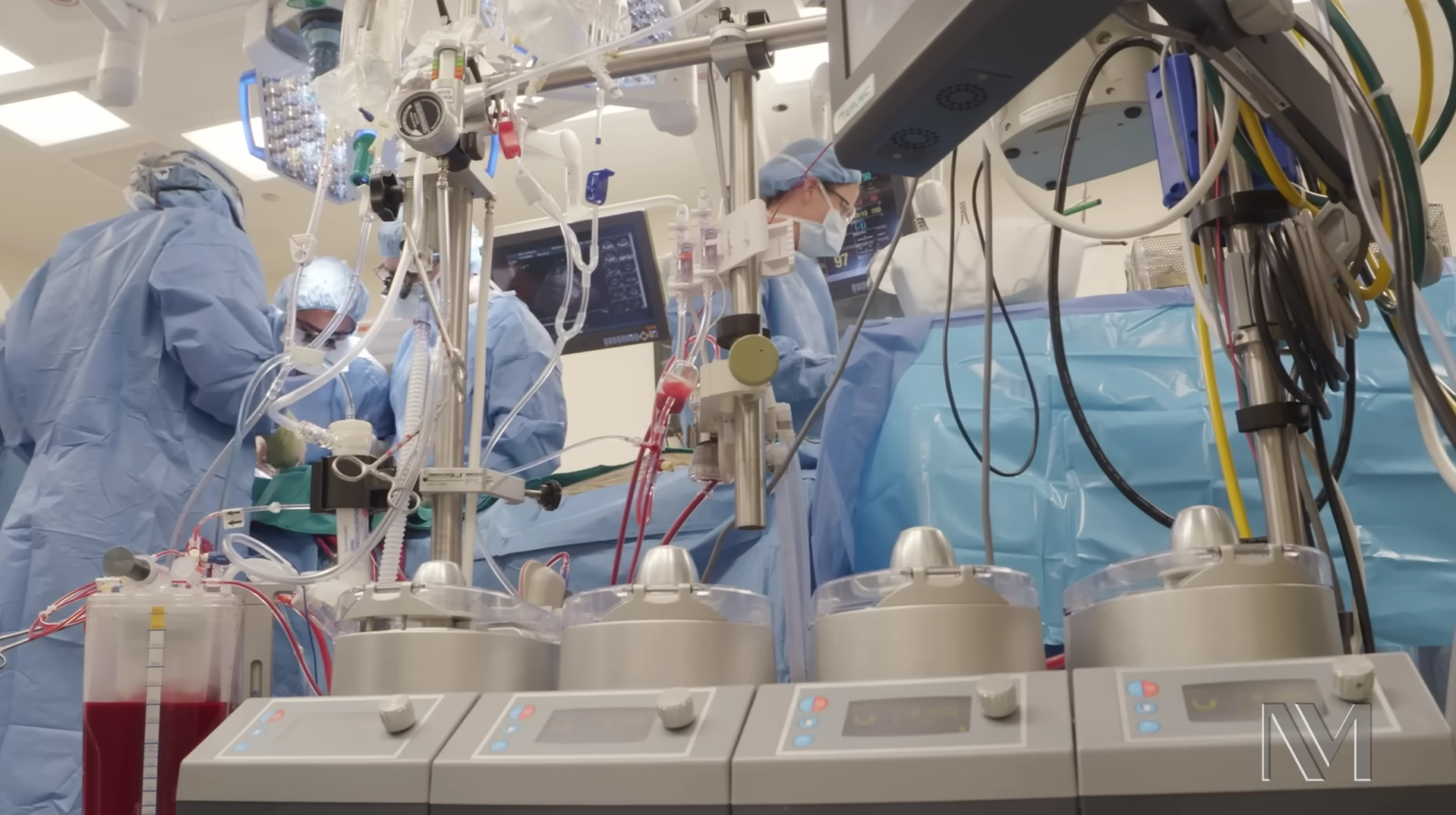 Kalp Nakli (Kardiyak Transplantasyon)